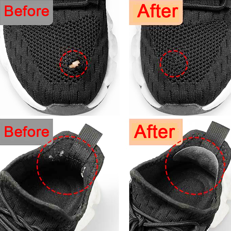 Sports Shoes Patches Vamp Repa – обзор и цена Sports Equipment Repair